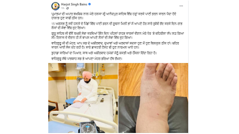 Snake-Bites-Cabinet-Minister-Harjot-Singh-Bains